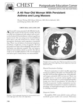 Asthma And Lung Mass