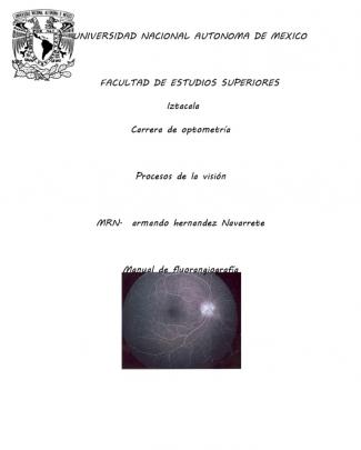 Manual De Fluorangiografia